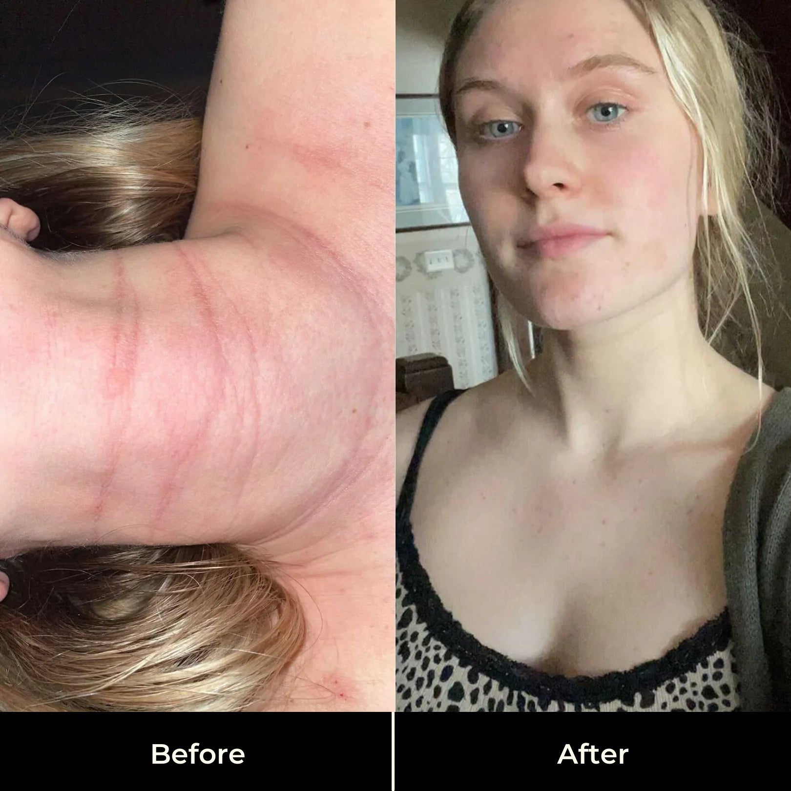 HEAL ALL OIL
