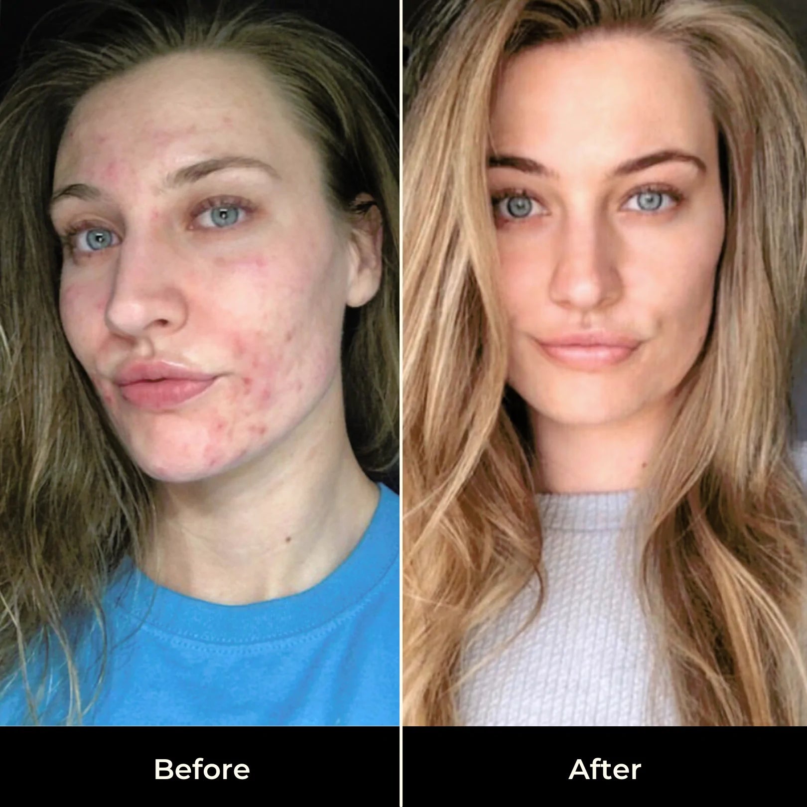 YOUTH BEAUTY FACE OIL